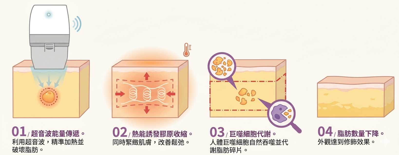 立倍塑超音波溶脂