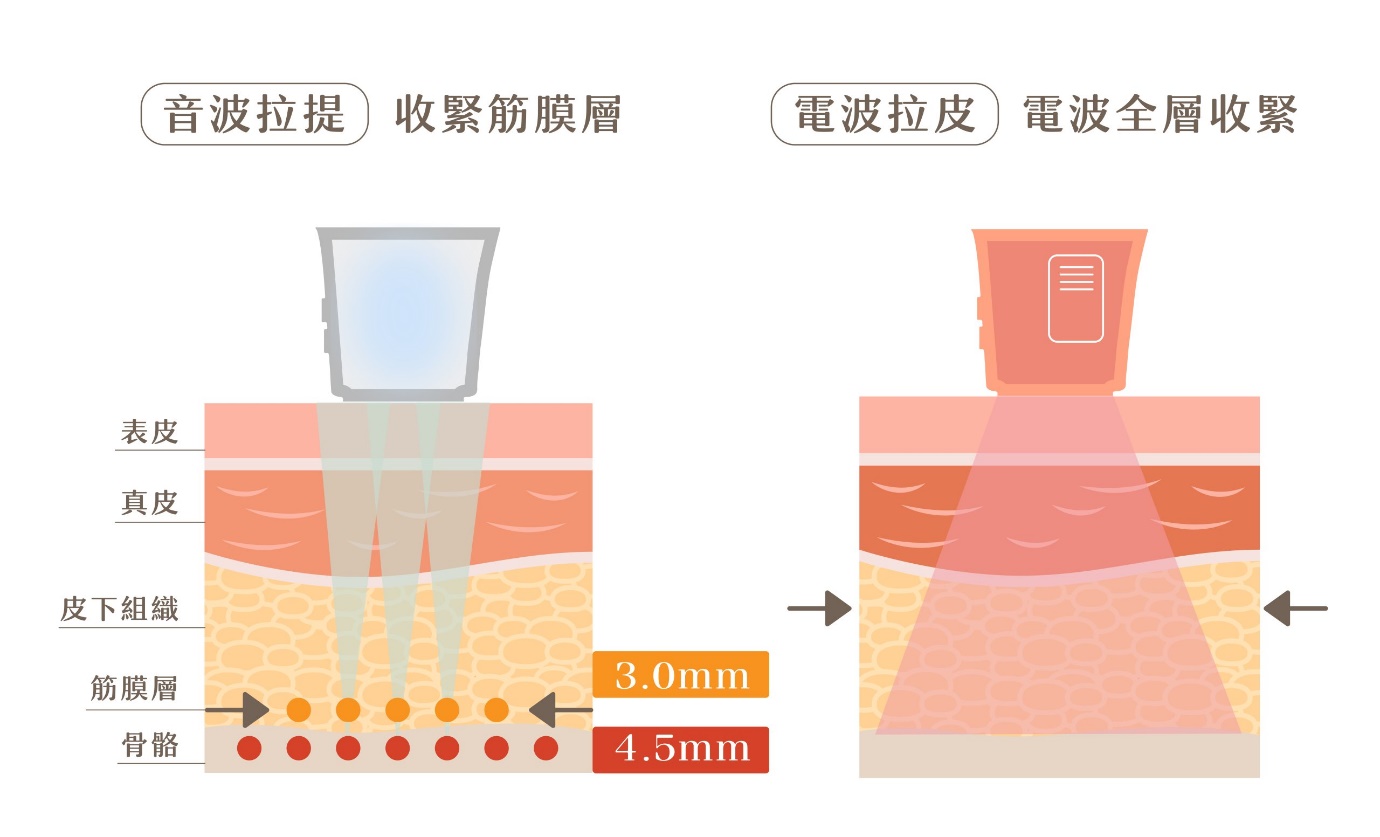 東妍診所 電波音波